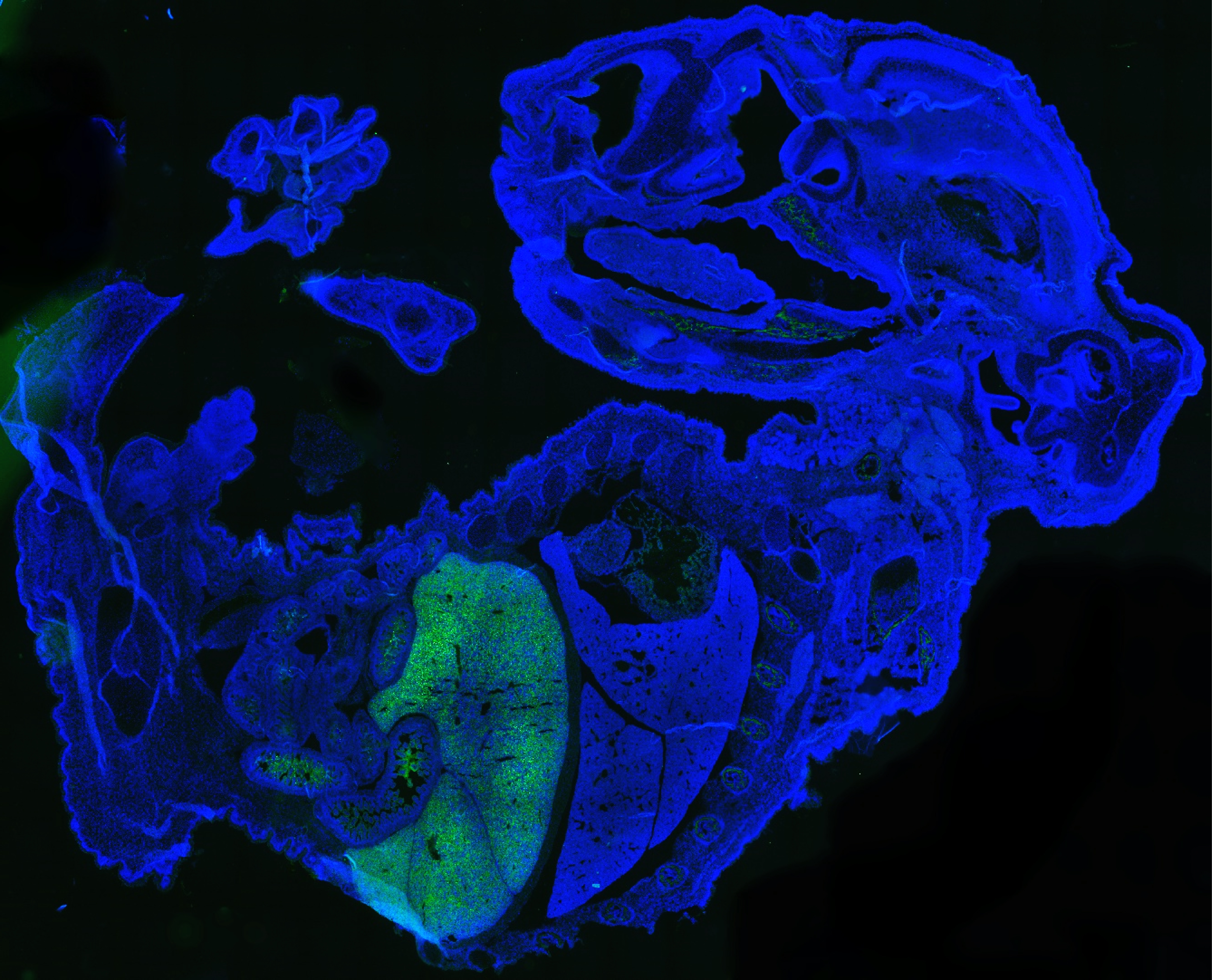 A mouse embryo shows up blue with a green area 