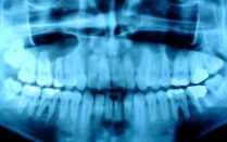 Dental x-ray. 