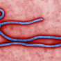 Ebola. 