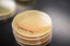 A stack of petri dishes holds streaks of yeast cells that have turned pink after students used CRISPR successfully to break a gene called ADE2. Credit: Douglas Levere / University at Buffalo
