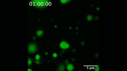Naturally occurring molecule stops Alzheimer’s-linked fibrils from forming