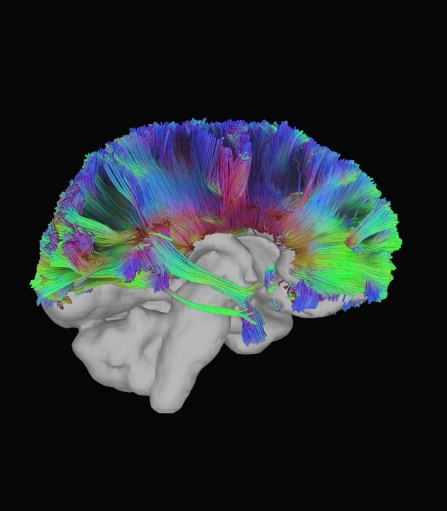 Zoom image: Brain's Blueprint: Mapping the Brain's Connectivity Using Tractography. (Credit: Elizabeth Castro) 