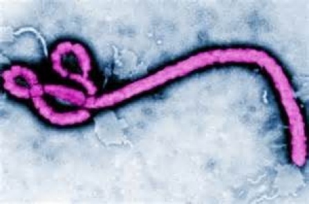 Microscopic view of the Ebola virus. 
