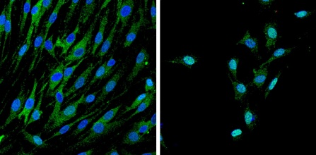 Myelination image of Yap and Taz proteins. 