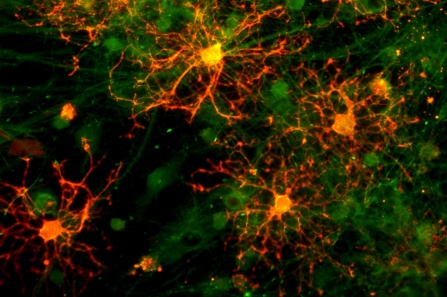 Oligodendrocytes with cortical neurons. 