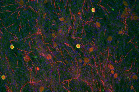Fluorescence microscopy image of in vitro model of myelin sheath formation by Schwann cells around neuronal axons. 
