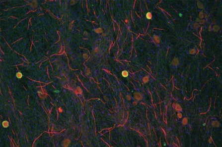 photo of metabolic pathway. 