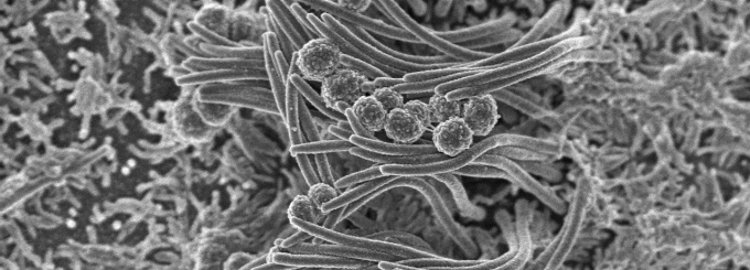 Scanning electron micrograph showing binding of the human respiratory tract pathogen, Moraxella catarrhalis, to cilia in primary human respiratory epithelial cells. Image: Peter Bush, Charmaine Kirkham, Tim Murphy. University at Buffalo. 