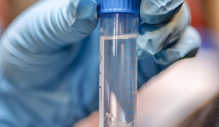Sample tube in gloved hand. 