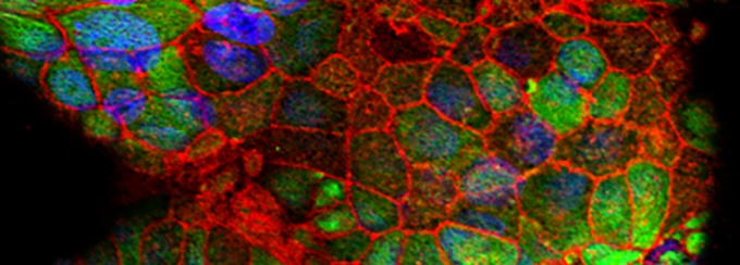 Photograph: 3-D cell placenta model mimics development, microbial resistance, NIH, 2016, CC. 