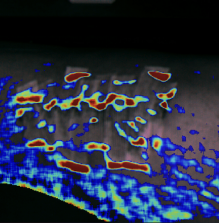 data from WaveSight. 