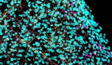 This image shows axons in vitro 24 hours after injury. The presence of Schwann cells (nuclei in cyan) helped maintain the integrity of axons (in magenta and yellow). Image credit: Elisabetta Babetto, HJKRI. 