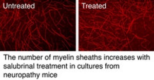 photo of untreated vs salubrinal treated culture from neuropathy mice. 