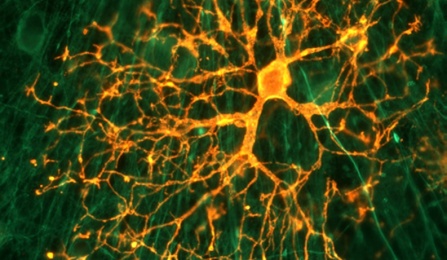 Zoom image: Fluorescent microscopy image showing an oligodendrocyte with branching processes involved in myelin formation in the central nervous system.. 