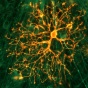 Zoom image: Fluorescent microscopy image showing an oligodendrocyte with branching processes involved in myelin formation in the central nervous system.. 