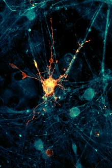 Zoom image: High‑magnification image of an oligodendrocyte lineage cell &nbsp;illustrating cellular morphology and myelin‑related structures. 