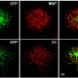 Zoom image: Image from a microscope of an example of a mature oligodendrocyte, as indicated by staining with mature oligodendrocyte markers, MBP and O1. 