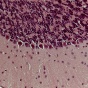 microscope image of cells, light purple and dark purple. 