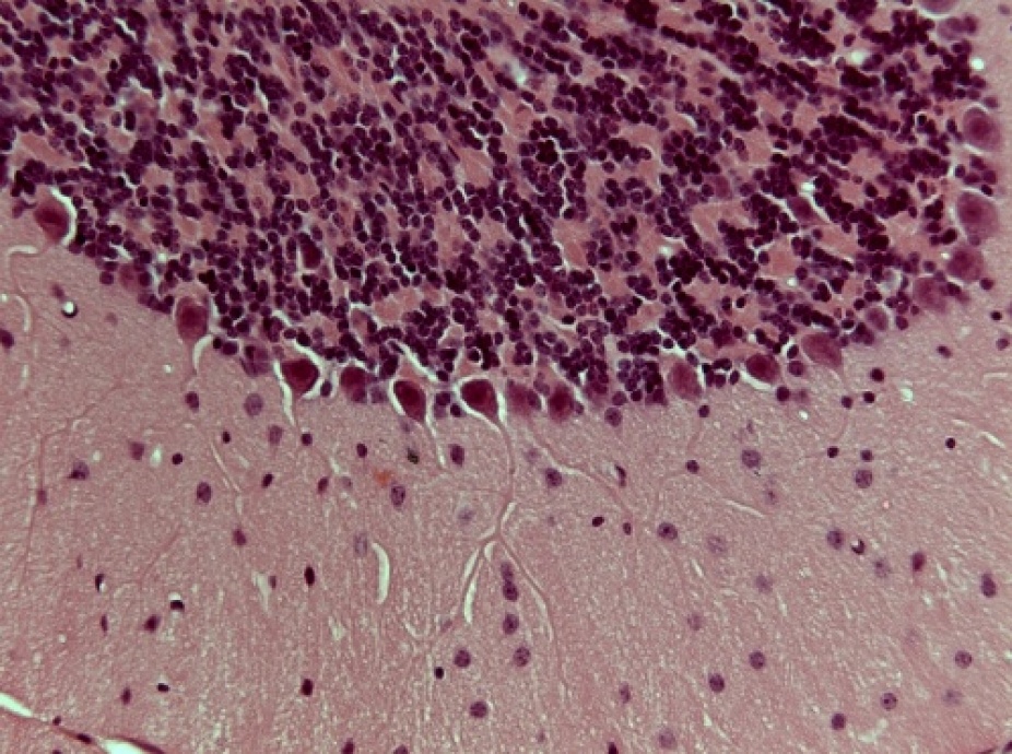 microscope image of cells, light purple and dark purple. 