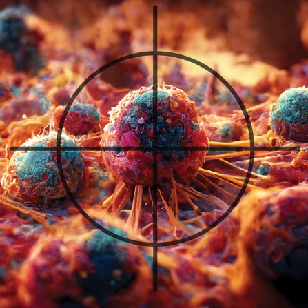 Close-up scientific illustration of cancer cells with a target crosshair centered on a prominent tumor cell, symbolizing precision medicine and targeted cancer therapy. 