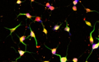 iPSC and Reprogramming research by Stelios Andreadis. 