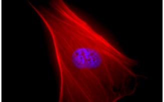 Mesenchymal Stem Cells. 