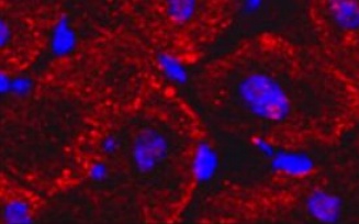 Cardiovascular research by Dr. John Canty. 