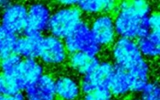 Neural Stem Cells research by Dr. Richard Gronostajski. 