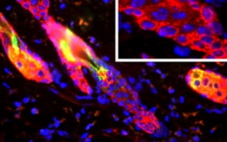 Epidermal Stem Cells research by Dr. Satrajit Sinha. 